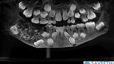 saveethadental.com, фото - Новости Zakon.kz от 01.08.2019 17:51